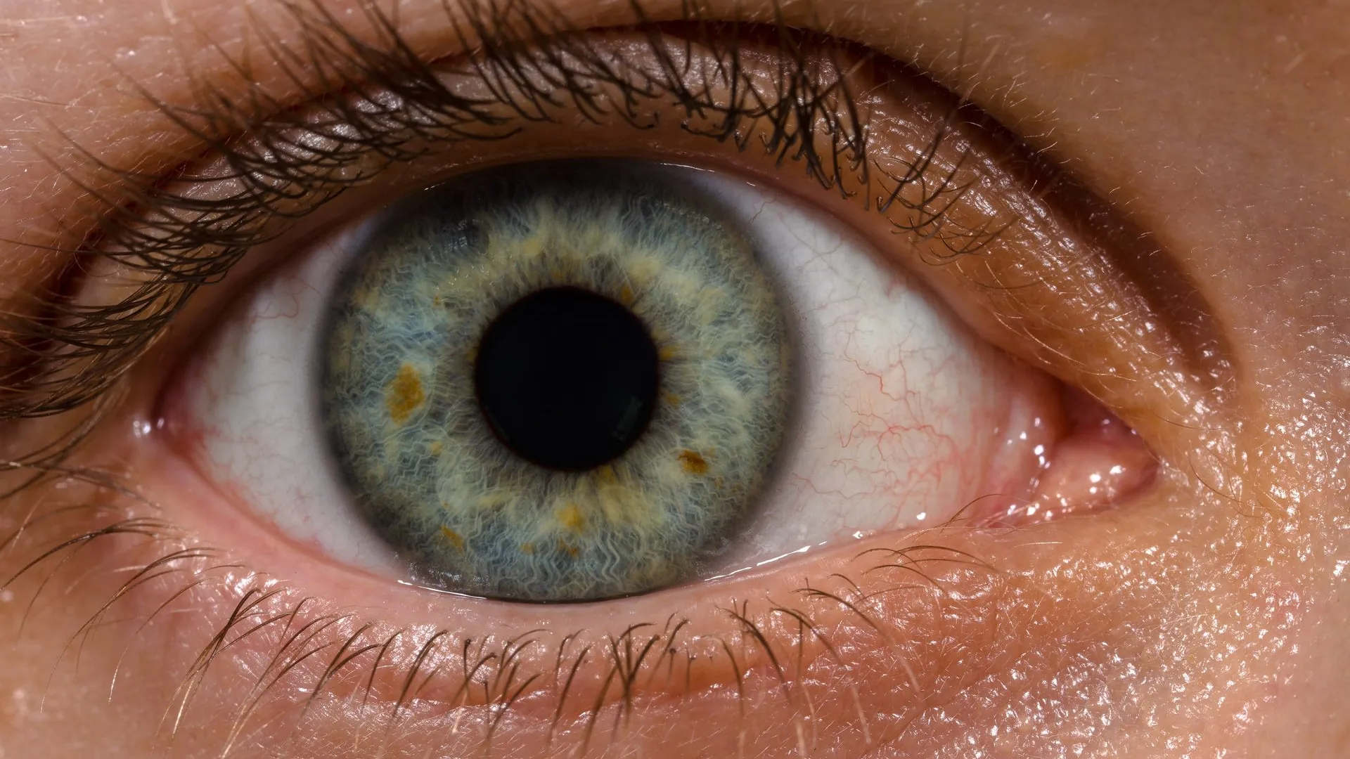 Close up photograph of a human eye with a blue grey iris flecked with yellow brown spots, a large black pupil, fine red blood vessels in the white and dark lashes above.